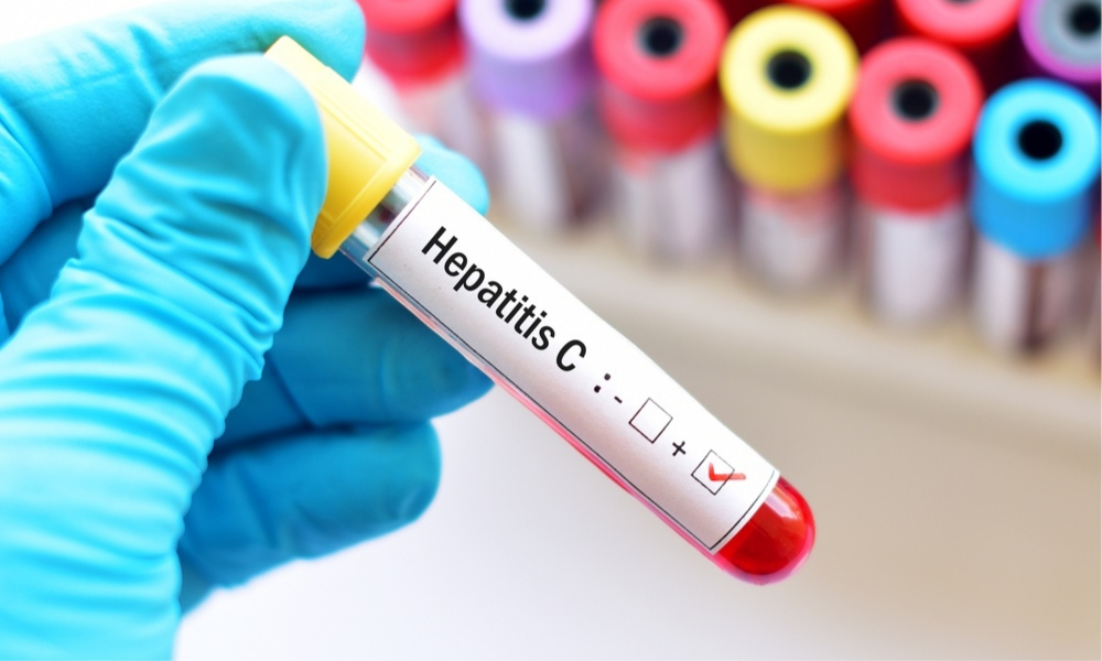 “L’eliminació de l’hepatitis no pot esperar”   